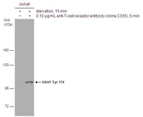 Anti-VAV1 (phospho Tyr174) antibody used in Western Blot (WB). GTX132787